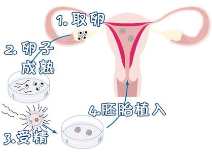好孕案例